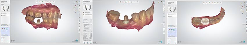 free metal dentistry workshop