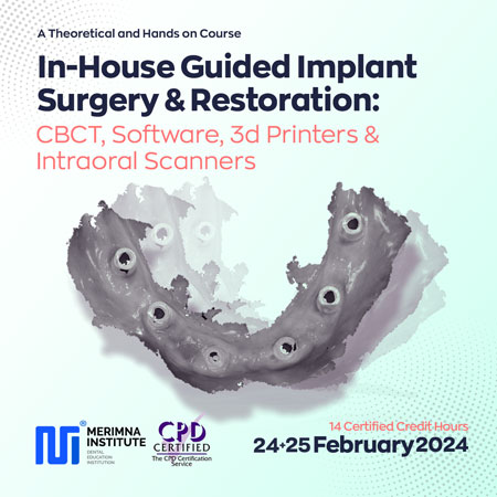 In-House Guided Implant Surgery & Restoration CBCT, Software, 3d Printers & Intraoral Scanners