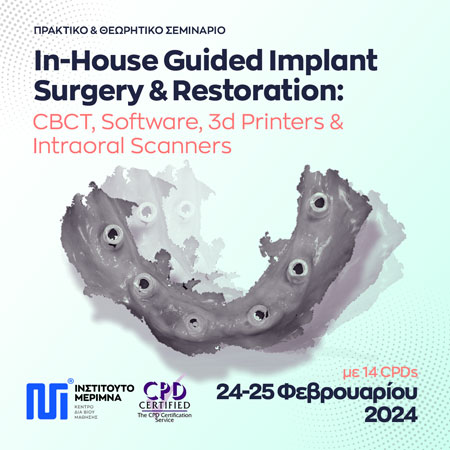 In-House Guided Implant Surgery & Restoration