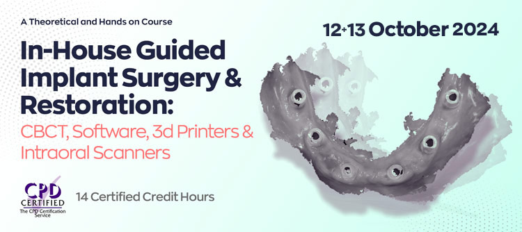 In-House Guided Implant Surgery & Restoration: CBCT, Software, 3d Printers & Intraoral Scanners
