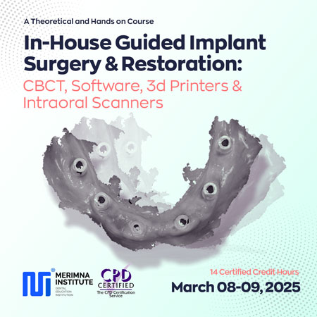 In-House Guided Implant Surgery & Restoration: CBCT, Software, 3d Printers & Intraoral Scanners