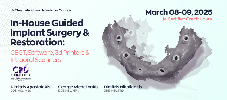 In-House Guided Implant Surgery & Restoration: CBCT, Software, 3d Printers & Intraoral Scanners