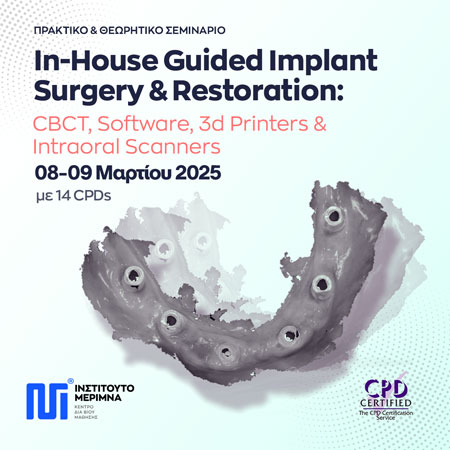 In-House Guided Implant Surgery and Restoration: CBCT, Software, 3d Printers and Intraoral Scanners