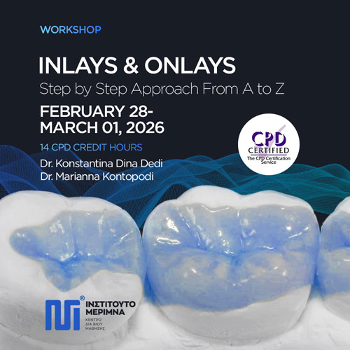 Inlays & Onlays - Step by Step Approach From A to Z 2026