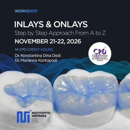 Inlays & Onlays - Step by Step Approach From A to Z 2026