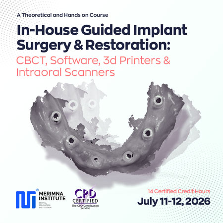 In-House Guided Implant Surgery and Restoration: CBCT, Software, 3d Printers and Intraoral Scanners