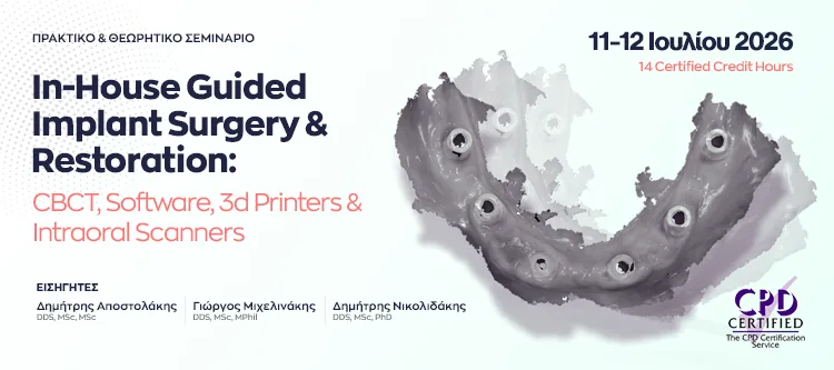 In-House Guided Implant Surgery and Restoration: CBCT, Software, 3d Printers and Intraoral Scanners