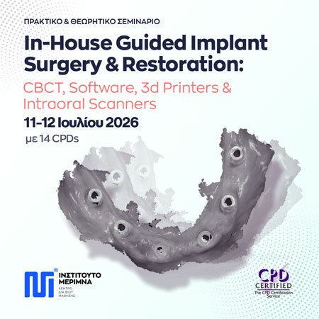 In-House Guided Implant Surgery & Restoration